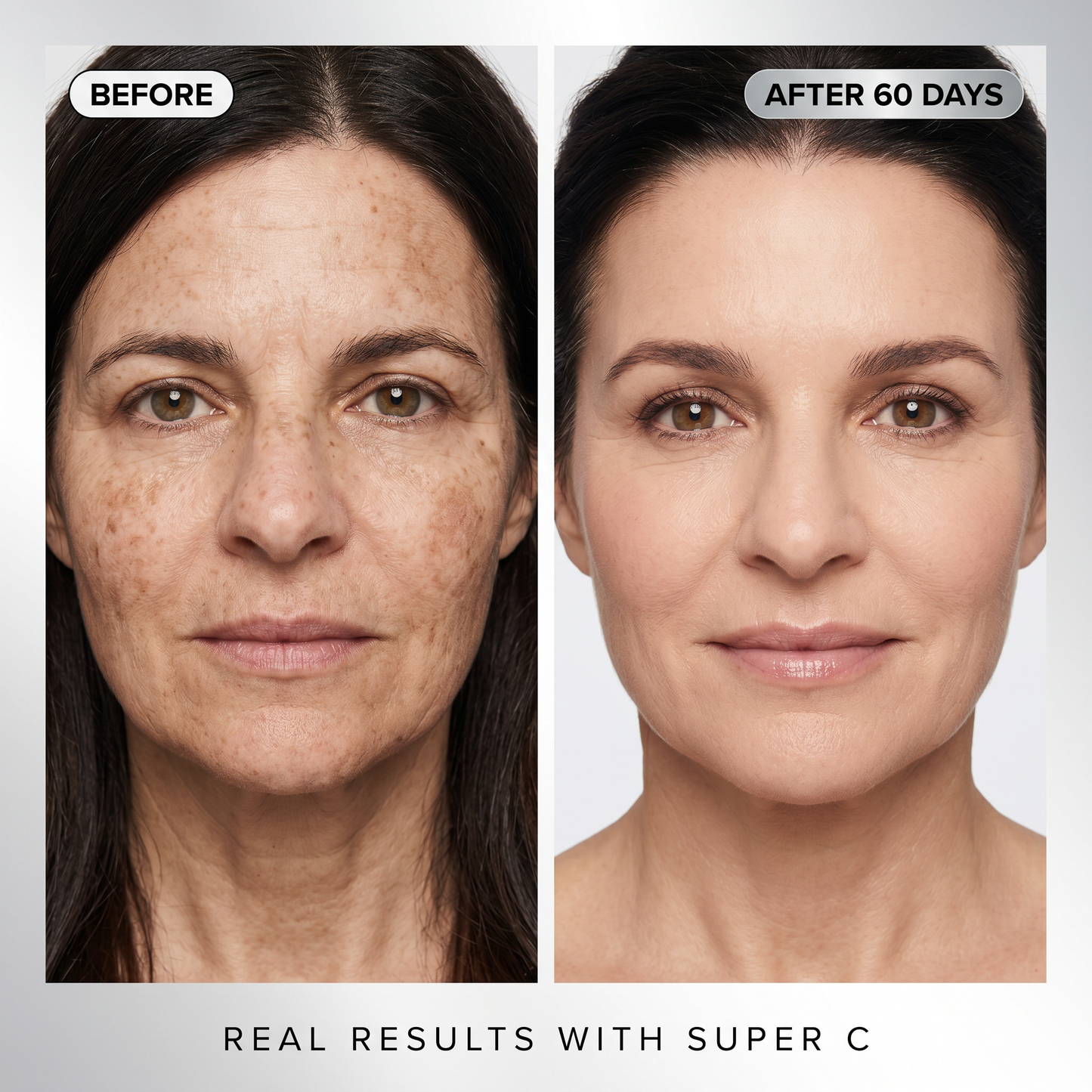 Ashfree Super C Serum